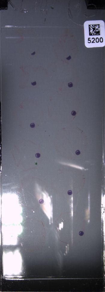 Media type: image; Special Collections 4011   shows specimen_part histological serial section;